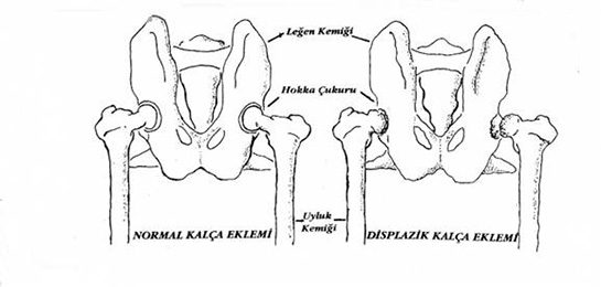 Kalça Çıkığı Belirtileri ve Tedavisi