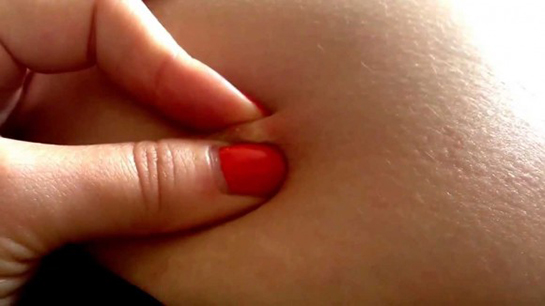 Kalçada Çıkan Sivilce Belirtileri ve Tedavisi