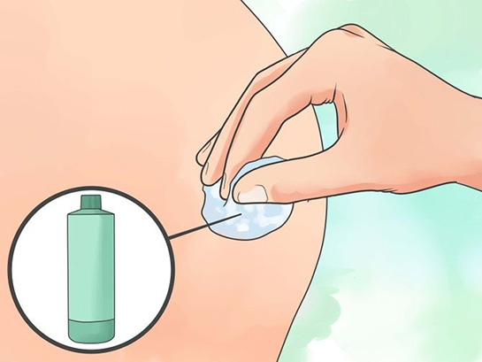 Kalçadan İğne Nasıl Yapılır?